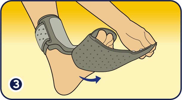 NightPlantarFasciitis