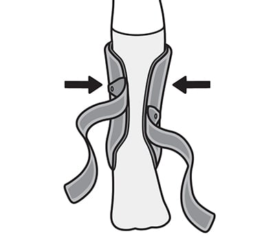 Opening straps and placing heel into bottom strap of ankle stirrup.